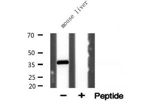 Western blot analysis of extracts from mouse liver, using AKR1CL2 antibody. (AKR1E2 Antikörper  (Internal Region))