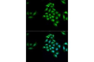 Immunofluorescence analysis of MCF7 cells using KLK4 antibody (ABIN6131853, ABIN6142954, ABIN6142955 and ABIN6222339). (Kallikrein 4 Antikörper  (AA 30-254))