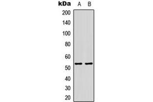 Western blot analysis of p53 (AcK386) expression in HepG2 (A), H9C2 (B) whole cell lysates. (p53 Antikörper  (acLys386, C-Term))