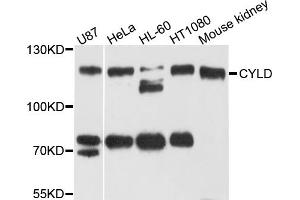 Western blot analysis of extracts of various cell lines, using CYLD antibody. (CYLD Antikörper)
