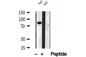 Western blot analysis of extracts of HepG2 cells, using PLOD3 antibody. (PLOD3 Antikörper  (C-Term))