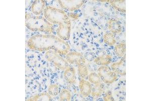 Immunohistochemistry of paraffin-embedded rat kidney using NB antibody (ABIN6132989, ABIN6144383, ABIN6144385 and ABIN6223030) at dilution of 1:200 (40x lens).
