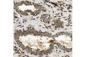 IHC analysis of ETF/TEAD2 using anti-ETF/TEAD2 antibody (ABIN7599879). (TEAD2 Antikörper  (AA 125-398))