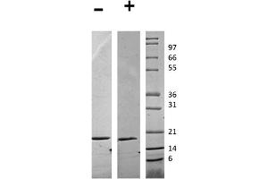 SDS-PAGE (SDS) image for Fms-Related tyrosine Kinase 3 Ligand (FLT3LG) protein (ABIN6699868)