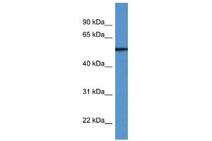 Western Blot showing TUBB6 antibody used at a concentration of 1-2 ug/ml to detect its target protein. (TUBb6 Antikörper  (N-Term))