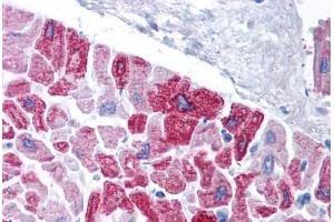 Human Heart (formalin-fixed, paraffin-embedded) stained with KCNH5 antibody ABIN214782 at 5 ug/ml followed by biotinylated goat anti-rabbit IgG secondary antibody ABIN481713, alkaline phosphatase-streptavidin and chromogen.