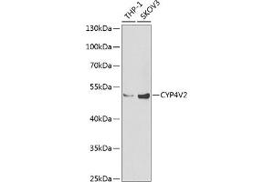 Western blot analysis of extracts of various cell lines, using CYP4V2 Antibody (ABIN6131089, ABIN6139368, ABIN6139369 and ABIN6222250) at 1:1000 dilution.