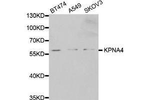 Western blot analysis of extracts of various cell lines, using KPNA4 antibody (ABIN5971058) at 1/1000 dilution. (KPNA4 Antikörper)