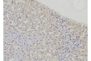 ABIN6274883 at 1/100 staining Mouse liver tissue by IHC-P.