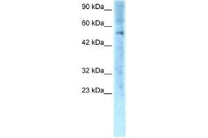 Human Jurkat; WB Suggested Anti-ZNF500 Antibody Titration: 0. (ZNF500 Antikörper  (Middle Region))
