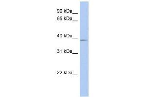 SLC25A28 antibody used at 1 ug/ml to detect target protein. (SLC25A28 Antikörper  (Middle Region))