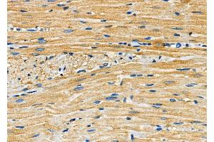 ABIN6260056 and ABIN6272251 at 1/100 staining Rat heart tissue by IHC-P. (ARRDC4 Antikörper  (Internal Region))