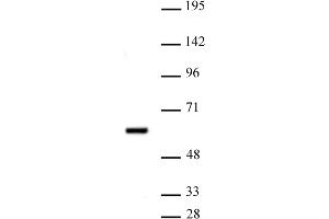 PRMT2 antibody (pAb) tested by Western blot. (PRMT2 Antikörper  (N-Term))