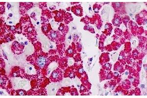 Human Liver: Formalin-Fixed, Paraffin-Embedded (FFPE)