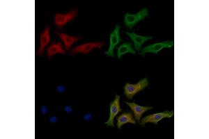 ABIN6262554 and ABIN6272583 staining HepG2 cells by IF/ICC.