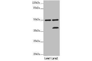 Western blot All lanes: PLIN5 antibody at 2 μg/mL Lane 1: Mouse kidney tissue Lane 2: Mouse brain tissue Secondary Goat polyclonal to rabbit IgG at 1/10000 dilution Predicted band size: 51 kDa Observed band size: 51, 36 kDa (PLIN5 Antikörper  (AA 305-453))