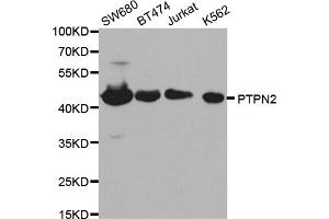Western blot analysis of extracts of various cell lines, using PTPN2 antibody (ABIN5970915) at 1/1000 dilution. (PTPN2 Antikörper)