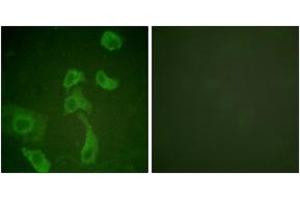 Immunofluorescence analysis of HeLa cells, using IL-2R beta (Ab-364) Antibody. (IL2 Receptor beta Antikörper  (AA 331-380))