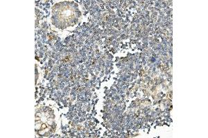 IHC analysis of Bid using anti-Bid antibody (ABIN7599062). (BID Antikörper  (AA 1-195))