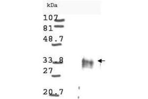 Western blot analysis is shown using  anti-Cyclin D1 antibody to detect Human Cyclin D1 present in asynchronous HN30 cell lysates. (Cyclin Antikörper)
