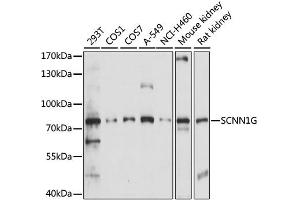 Western blot analysis of extracts of various cell lines, using SCNN1G antibody. (SCNN1G Antikörper)