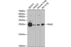 Western blot analysis of extracts of various cell lines, using RALB antibody (ABIN1682468, ABIN5664619, ABIN5664621 and ABIN6220484) at 1:1000 dilution.