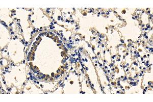Immunohistochemistry (IHC) image for anti-Transforming Growth Factor, beta 1 (TGFB1) (AA 279-390) antibody (ABIN7429469)