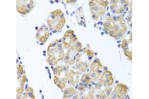 Immunohistochemistry of paraffin-embedded Human stomach using GLS Polyclonal Antibody at dilution of 1:100 (40x lens). (Glutaminase Antikörper)