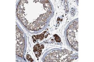 Immunohistochemical staining of human testis with WIPF3 polyclonal antibody  shows moderate cytoplasmic positivity in cells in seminiferus ducts and strong staining in Leydig cells at 1:50-1:200 dilution. (WIPF3 Antikörper)