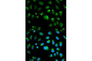 Immunofluorescence analysis of HeLa cells using TLR1 antibody.
