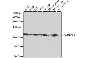 Western blot analysis of extracts of various cell lines, using SMARCA5 antibody. (SMARCA5 Antikörper  (AA 100-400))