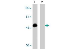 Western blot analysis using CX3CR1 polyclonal antibody  at 1 ug/mL on THP-1 cell lysate in the absence (lane 1) and presence (lane 2) of specific blocking peptide. (CX3CR1 Antikörper  (AA 175-189))