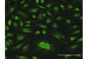 Immunofluorescence of purified MaxPab antibody to CDKN2D on HeLa cell. (CDKN2D Antikörper  (AA 1-166))