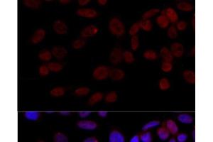 Immunofluorescence analysis of HeLa cells using JNK1 Polyclonal Antibody at dilution of 1:100 (40x lens). (JNK Antikörper)