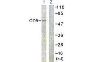 Western Blotting (WB) image for anti-CD5 (CD5) (AA 421-470) antibody (ABIN2888797) (CD5 Antikörper  (AA 421-470))