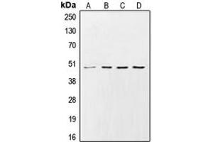 Western blot analysis of CK1 gamma 2 expression in HeLa (A), Raw264. (Casein Kinase 1 gamma 2 Antikörper  (N-Term))