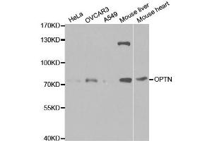 Western Blotting (WB) image for anti-Optineurin (OPTN) antibody (ABIN1874007)