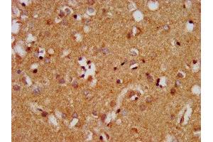 IHC image of ABIN7159750 diluted at 1:400 and staining in paraffin-embedded human brain tissue performed on a Leica BondTM system. (MAP1A Antikörper  (AA 1979-2168))