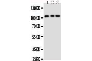 Anti-TRPC6 antibody, Western blotting Lane 1: Rat Lung Tissue Lysate Lane 2: 293T Cell Lysate Lane 3: 293T Cell Lysate (TRPC6 Antikörper  (Middle Region))