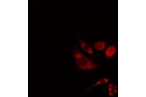 ABIN6276291 staining 293 cells by IF/ICC. (BAK1 Antikörper  (N-Term))