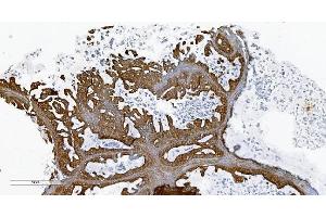 IHC analysis of PLTP using anti-PLTP antibody (ABIN7600346). (PLTP Antikörper  (AA 18-470))