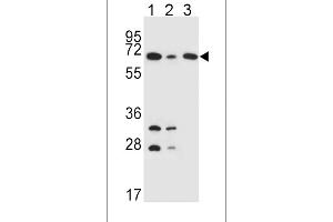 DLAT Antibody (C-term) (ABIN651534 and ABIN2840283) western blot analysis in K562(lane 1),HepG2(lane 2),Jurkat(lane 3) cell line lysates (35 μg/lane). (DLAT Antikörper  (C-Term))