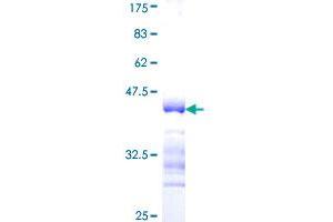 Image no. 1 for Interleukin 17F (IL17F) (AA 31-140) protein (GST tag) (ABIN1307713) (IL17F Protein (AA 31-140) (GST tag))