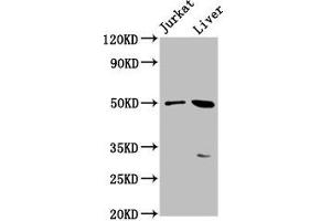 Western Blot Positive WB detected in: Jurkat whole cell lysate, Mouse liver tissue All lanes: BPIFB3 antibody at 3. (BPIFB3 Antikörper  (AA 248-352))