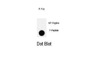 Dot blot analysis of PDX1 Antibody (T11) Pab (ABIN650810 and ABIN2839791) on nitrocellulose membrane. (PDX1 Antikörper  (pThr11))