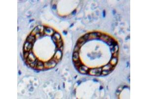 Immunohistochemistry (IHC) image for anti-Cadherin 1, Type 1, E-Cadherin (Epithelial) (CDH1) (AA 751-884) antibody (ABIN7437818)