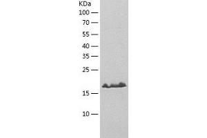Western Blotting (WB) image for phosphopantothenoylcysteine Decarboxylase (PPCDC) (AA 1-204) protein (His-IF2DI Tag) (ABIN7124439)