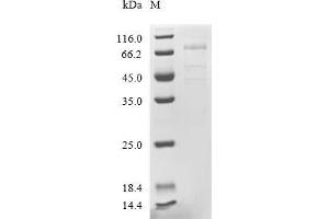 Lipase, Endothelial (LIPG) (AA 21-500), (full length) protein (G4S-His Tag)