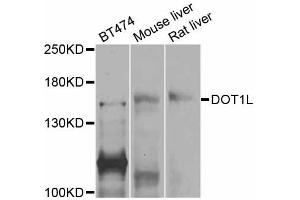 Western blot analysis of extracts of various cell lines, using DOT1L antibody (ABIN5997612) at 1/1000 dilution.