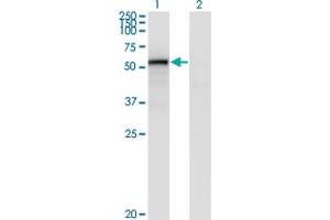 Western Blot analysis of ENG expression in transfected 293T cell line by ENG monoclonal antibody (M01), clone 4C11. (Endoglin Antikörper  (AA 27-658))